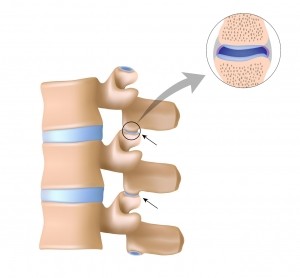 Facet joints