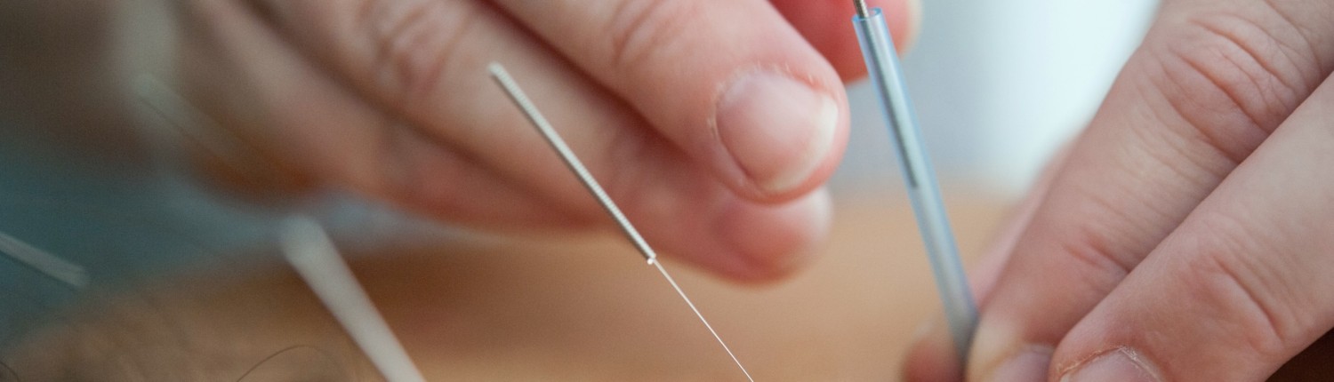 Dry needling technieken bij Fysiotherapie - Fysiopark