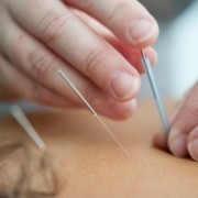 Dry needling technieken bij Fysiotherapie - Fysiopark